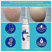 FOOTLOGIX Cracked Heel Formula, White 4.23 Ounce