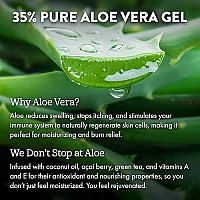 ALOE UP After Sun Light Moisturizer Skin Care - Body Moisturizer uses Aloe Vera Gel, Coconut Oil, and Vitamin E for After Sun Care/Beach Essential Sun Lotion Soothes Sunburned Skin / 4 oz