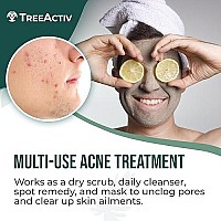 Four-in-One Acne Treatment, Exfoliating Sulfur Acne Face Wash, Bentonite Clay Face Mask & Acne Spot Treatment, Pore Clarifying Facial Scrub for Adult, Teens, Women, & Men, 250+ Treatments by TreeActiv