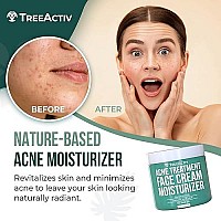 Treeactiv Acne Treatment Face Cream Moisturizer | Tea Tree & Salicylic Acid Lotion For Pimple, Blackhead, Whitehead, Milia Removal | Hydrating Facial Cream For Sensitive & Oily Skin | 90-Day Supply