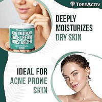 Treeactiv Acne Treatment Face Cream Moisturizer | Tea Tree & Salicylic Acid Lotion For Pimple, Blackhead, Whitehead, Milia Removal | Hydrating Facial Cream For Sensitive & Oily Skin | 90-Day Supply