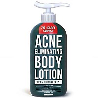 TreeActiv Acne Eliminating Body Lotion - Cucumber Mint Scent, 2% Salicylic Acid Moisturizer Lotion - Body Acne Treatment And Butt Acne Clearing Treatment for Women and Men, Non-GMO