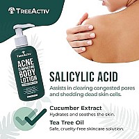 TreeActiv Acne Eliminating Body Lotion - Cucumber Mint Scent, 2% Salicylic Acid Moisturizer Lotion - Body Acne Treatment And Butt Acne Clearing Treatment for Women and Men, Non-GMO