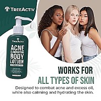 TreeActiv Acne Eliminating Body Lotion - Cucumber Mint Scent, 2% Salicylic Acid Moisturizer Lotion - Body Acne Treatment And Butt Acne Clearing Treatment for Women and Men, Non-GMO