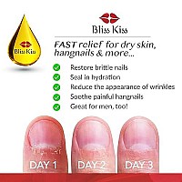 Bliss Kiss | Fragrance Free | Nail Oil Cuticle Dropper w/Vitamin E & Jojoba?Nail Strengthener Nail Growth Treatment for Brittle Peeling Breaking Thin Nails | 0.5oz |