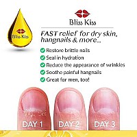 Bliss Kiss | Crisp Fragrance | Nail Oil Cuticle Dropper w/Vitamin E & Jojoba?Nail Strengthener Nail Growth Treatment for Brittle Peeling Breaking Thin Nails | 0.5oz |