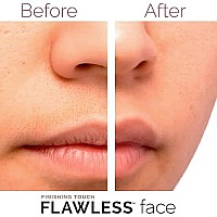 Finishing Touch Flawless Facial Hair Remover for Women, White/Rose Gold Electric Face Razor for Women with LED Light for Instant and Painless Hair Removal