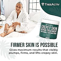 TreeActiv Crepey Skin Repair Treatment, 8oz, Firming Crepe Skin Cream with Hyaluronic Acid & Shea Butter to Deeply Moisturize & Tighten Wrinkly Dry Crepe Skin, 500+ Uses