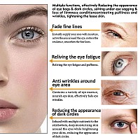 Miescher Eye Peptide Serum Eye Massage Roller Nourishing Relieve Loose Eye Bags Dark Circles Eye Skin Care Under Eye Cream For F