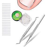 50 2 Pack Professional Ingrown Toenail Correction Treatment Kit 50 Pcs Ingrown Toenail Corrector Straightener Strips Recover