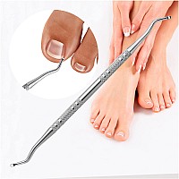 302 Pack Ingrown Toenail Correction Treatment Kit 30Pcs Ingrown Toenail Corrector Strips Brace Ingrown Toenail Pedicure Tool