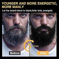 Mglimz Mens Gray To Black Beard Dye For Instant Easy Coloring And Grooming 10 Pcs