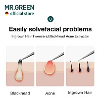 Mrgreen Ingrown Hair Tweezers Needle Nose Pointed Tips Tweezers For Eyebrows Splinters Blackhead Removal Acne Clip Extractor L