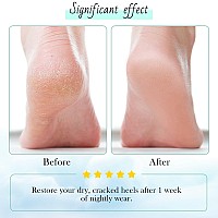 Moisturizing Gel Heel Socks For Dry Cracked Feet Shynek 3 Pairs Spa Socks Lotion Toeless Socks For Women Dry Cracked Heel Feet