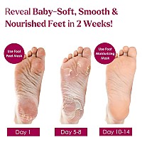 Foot Mask Spa Kit Pack Of 8 2X Foot Peeling Mask 6X Hydrating Foot Masks With Fuzzy Socks For Dry Cracked Heels Calluses